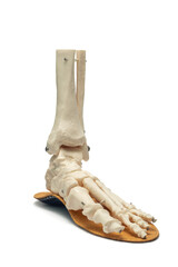 Anatomical model of human foot bones with orthopedic insole isolated on white background. Treatment and prevention of foot diseases