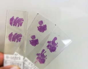 Close view of Histopathology slides stained with hematoxylin and eosin or HE stain, ready for microscopic examination with Laboratory background, Histology.