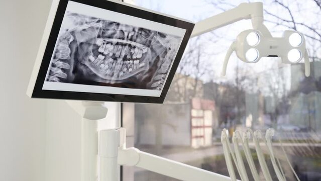 Close-up shot of panoramic x-ray of milk teeth on the screen in modern dental office. Patient x-ray results on display. Examining teeth in the dental clinic. Professional consultation in dentistry.