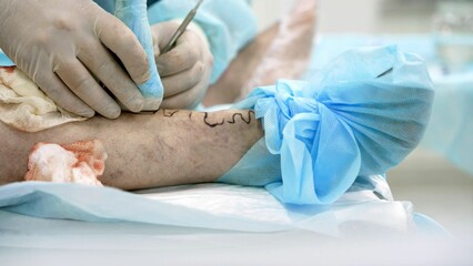 Nurses dressing a leg wound in the ankle of a patient sitting on the stretcher with bandages....