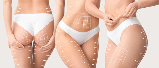 Young women with cellulite on light background