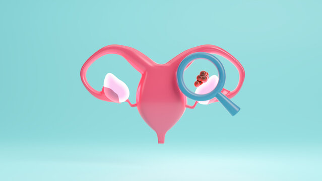 World Day of Ovarian Cancer, May 8, uterus reproductive system, Ovarian cancer illness in women's health, Gynecological, Uterine cancer, Vulvar cancer, Panic disorder.Copy space.3d render illustration