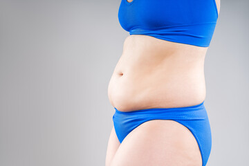 Tummy tuck, flabby skin on a fat belly, plastic surgery concept on gray background - 767679044