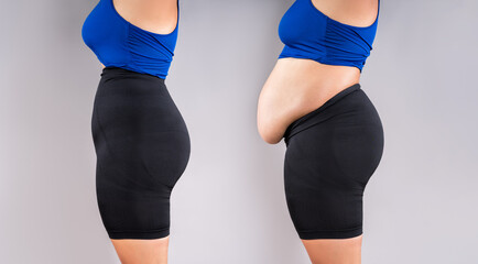 Woman's body before and after weight loss, flabby belly after pregnancy, fat woman in corrective panties on grey background, plastic surgery concept - 767681861