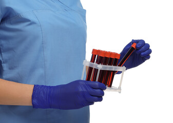 Laboratory testing. Doctor with blood samples in tubes on white background, closeup