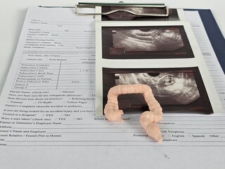 Medical on ultrasound images of the intestines. Ultrasound of the intestines and health problems...