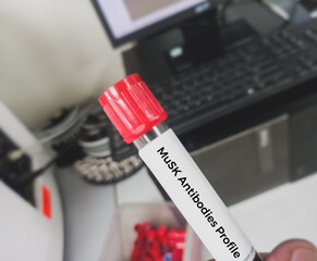 Blood sample for MuSK (muscle-specific kinase) antibody profile test to diagnosis Myasthenia gravis...