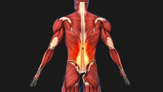 Damaged muscle tissue causes back pain