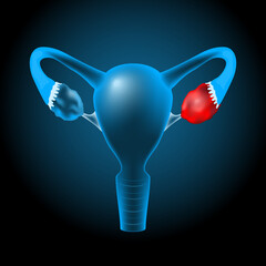Realistic transparent blue human uterus with glowing effect on dark background