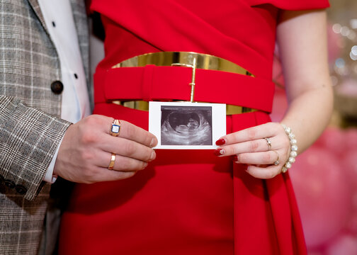 Expectant parents hold a sonogram image of an unborn child
