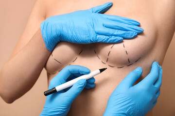 Doctor drawing marks on female breast before cosmetic surgery operation against brown background