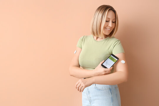 Diabetic woman with glucose sensor using mobile phone for measuring blood sugar level on beige background