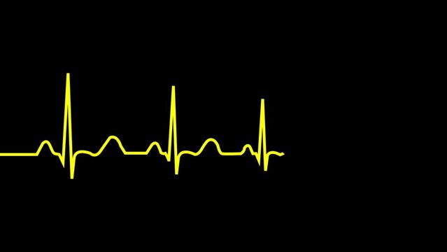 Heartbeat rate animation. Pulse footage. Heart beat  Pulsing beat animation. Cardio wave monitor. EKG chart. animation Single solid line art cardiogram anatomical human heart silhouette. 