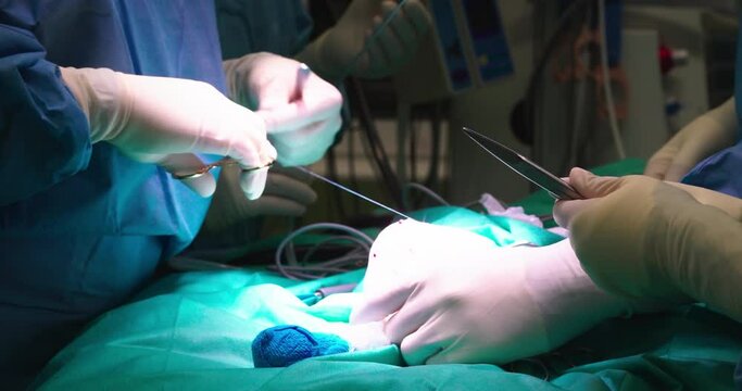 Surgeon stitches up wound in the operating room