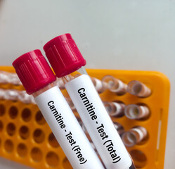 Blood sample for Carnitine (Total and Free) test to diagnosis of primary carnitine deficiency for various muscle disorders.