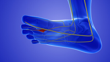 Neuroma painful foot condition or pinched nerve - obrazy, fototapety, plakaty