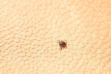 parasitiform tick from order Ixodidae, blood-sucking parasites on skin, Acariformes, carrier of...