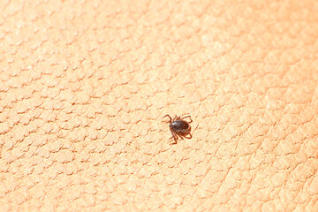 parasitiform tick from order Ixodidae, blood-sucking parasites on skin, Acariformes, carrier of dangerous disease encephalitis, surveillance systems, tick-borne disease prevention strategies