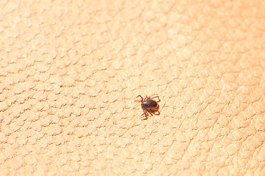 parasitiform tick from order Ixodidae, blood-sucking parasites on skin, Acariformes, carrier of dangerous disease encephalitis, surveillance systems, tick-borne disease prevention strategies