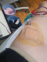 blood donation at Korea