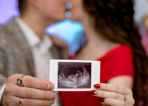 Expectant parents hold a sonogram image of an unborn child	