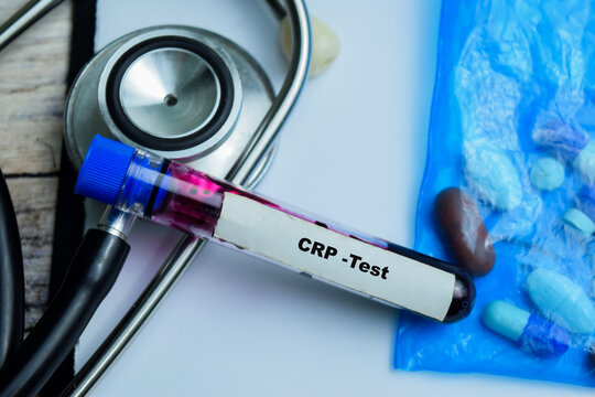 CRP - Test with blood sample on wooden background. Healthcare or medical concept