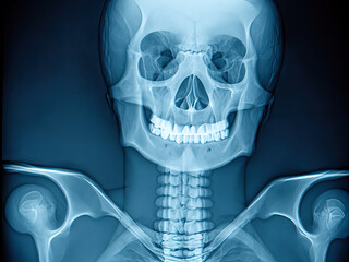 crâne humain aux rayons x