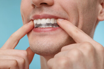 Young man applying whitening strip on his teeth against light blue background, closeup