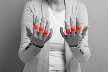 Arthritis symptoms. Woman suffering from pain in her fingers on background, closeup. Black and...