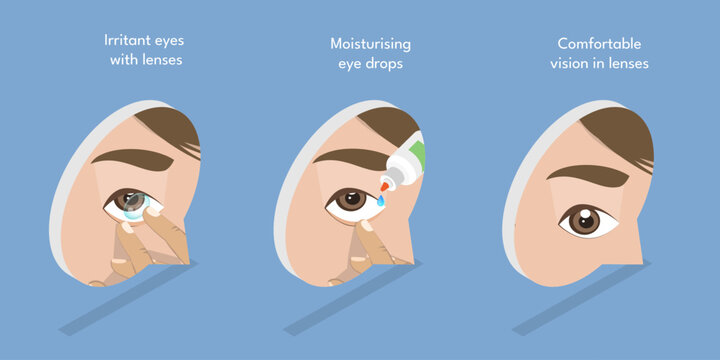 3D Isometric Flat Vector Illustration of Moisturizing Eye Drops, Using of Artificial Tears