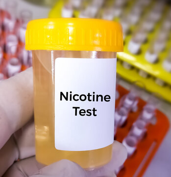 Urine test sample for Cotinine or Nicotine test, an alkaloid found in tobacco and also the predominant metabolite of nicotine, it is used as a biomarker for exposure to tobacco smoke.