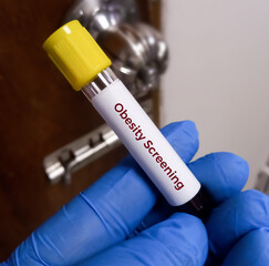 Blood sample for Obesity screening test, Lipid profile, lipid panel testing.