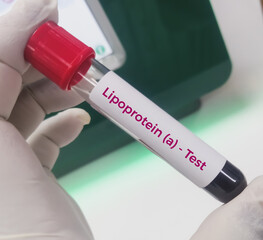 Blood sample for lipoprotein (a) or LpA blood test. Lipid profile. to diagnosis of high risk for...