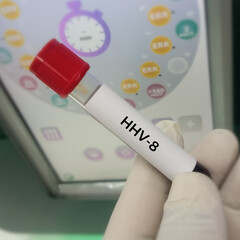 Blood sample for HHV 6(Human Herpesvirus 6) and HHV-8 test, roseola