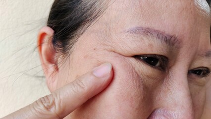 Obraz premium close up the flabbiness and wrinkle beside the eyelid, dark spots and blemish, freckles and loose on the face of the woman, health care and beauty concept.