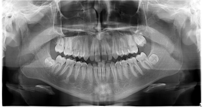 HUMAN PATHOLOGICAL AND ANATOMICAL RADIOGRAPHY