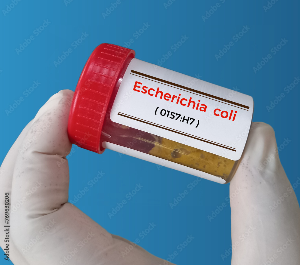 Wall mural Stool sample for Escherichia coli (E. coli) O157:H7 test. Serotype of Escherichia coli bacteria.