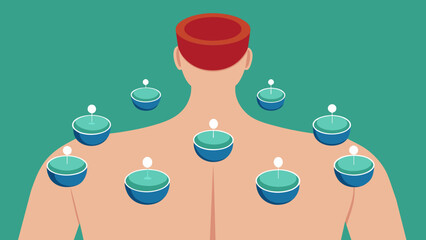  A closeup of a set of small glass cups being arranged on a patients back. The cups are strategically p along energy pathways known as meridians. - obrazy, fototapety, plakaty