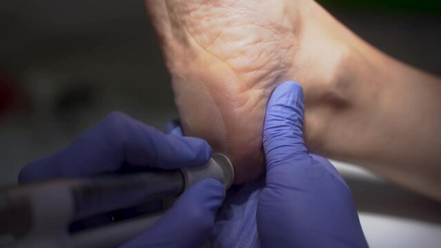 Podologist cleaning the heel of the foot in slow motion