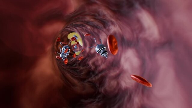 Blood Vessel: Nanobots Removing Cholesterol