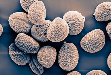 pollen grains photographed with an electron microscope