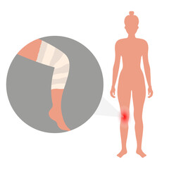 Injured leg with bandage