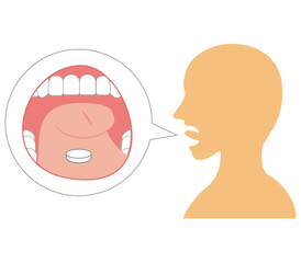 花粉症やダニアレルギーの治療としての舌下免疫療法のやり方