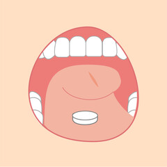 舌に薬を置くことで花粉症やアレルギーを予防する舌下免疫療法のやり方