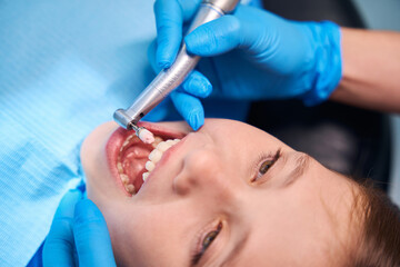 Polishing the teeth of a teenage girl