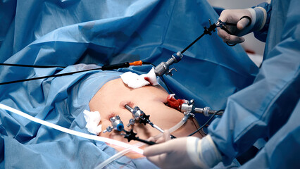 A group of professional surgeons in the operating room. Close-up of a surgical operation. Plastic...