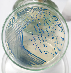 Growing Enterobacter spp bacteria in chromogenic agar medium in microbiology lab. Micro-organisms...