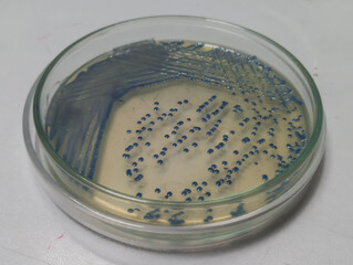 Growing Enterobacter spp bacteria in chromogenic agar medium in microbiology lab. Micro-organisms...