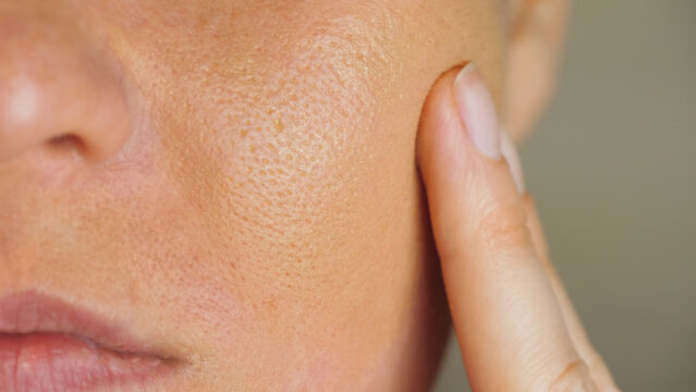 skin with enlarged pores and foundation. Problem clogged skin