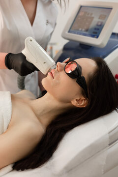 laser hair removal